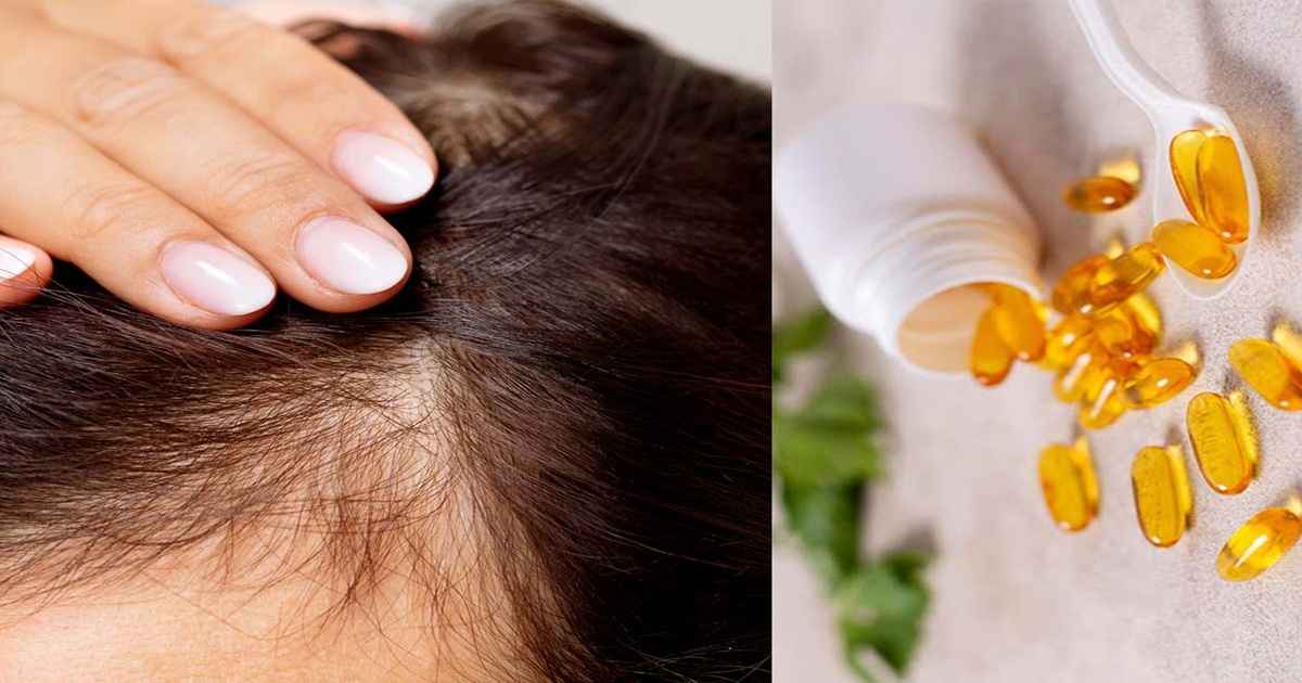  پوسیدگی استخوان، یکی از علائم کمبود ویتامین دی در بدن است.